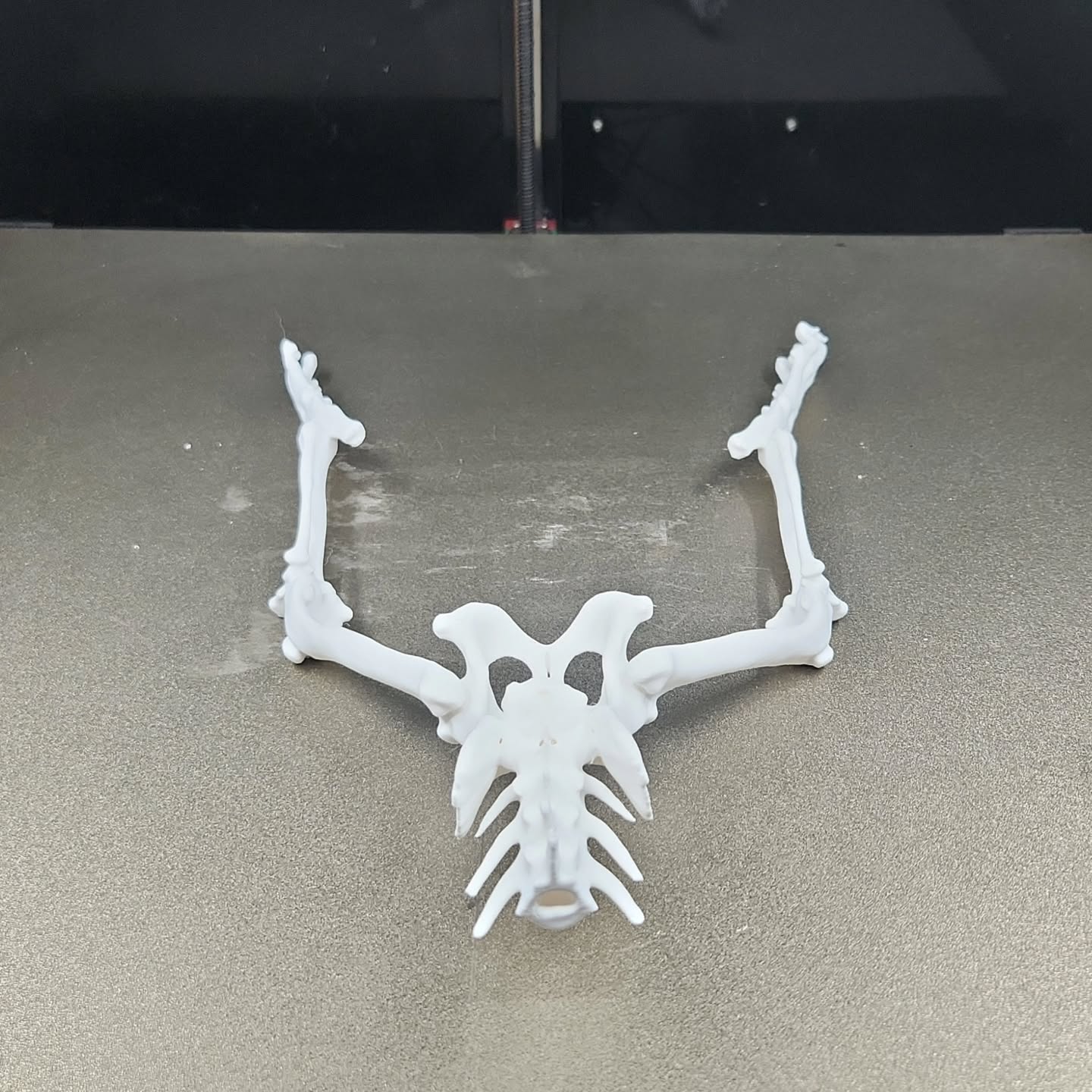 Bone