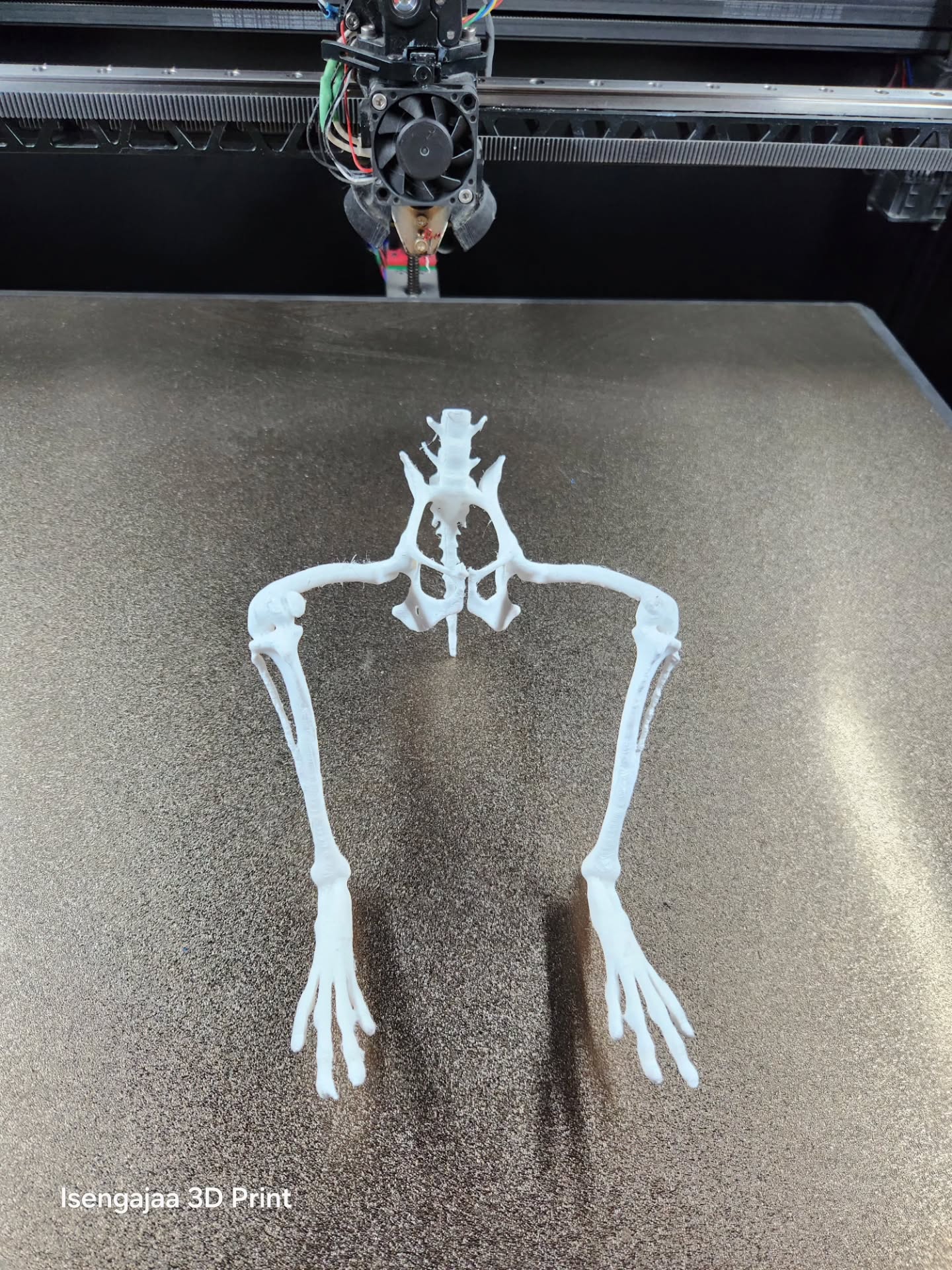 Bone